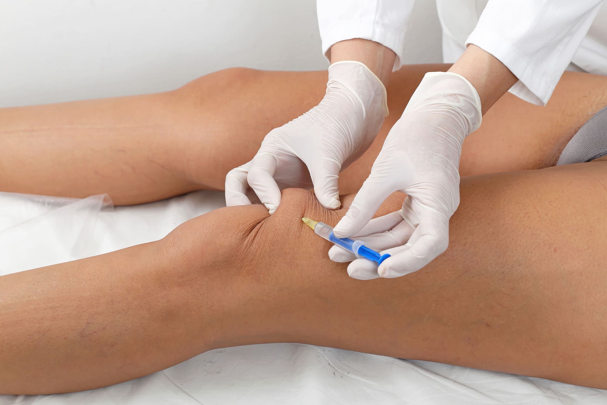 The Science of Knee Gel Injections: How They Work and Why They're Effective