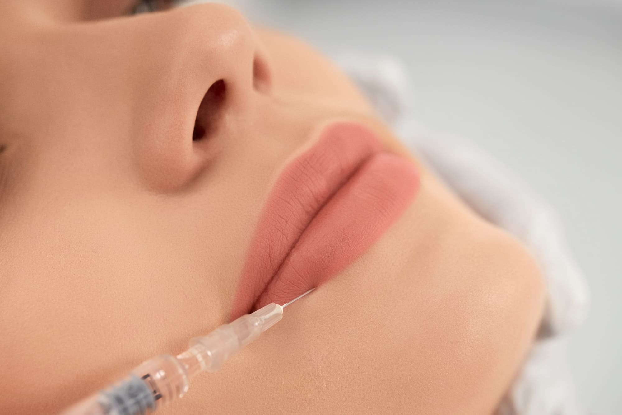 lips being implanted with a filler