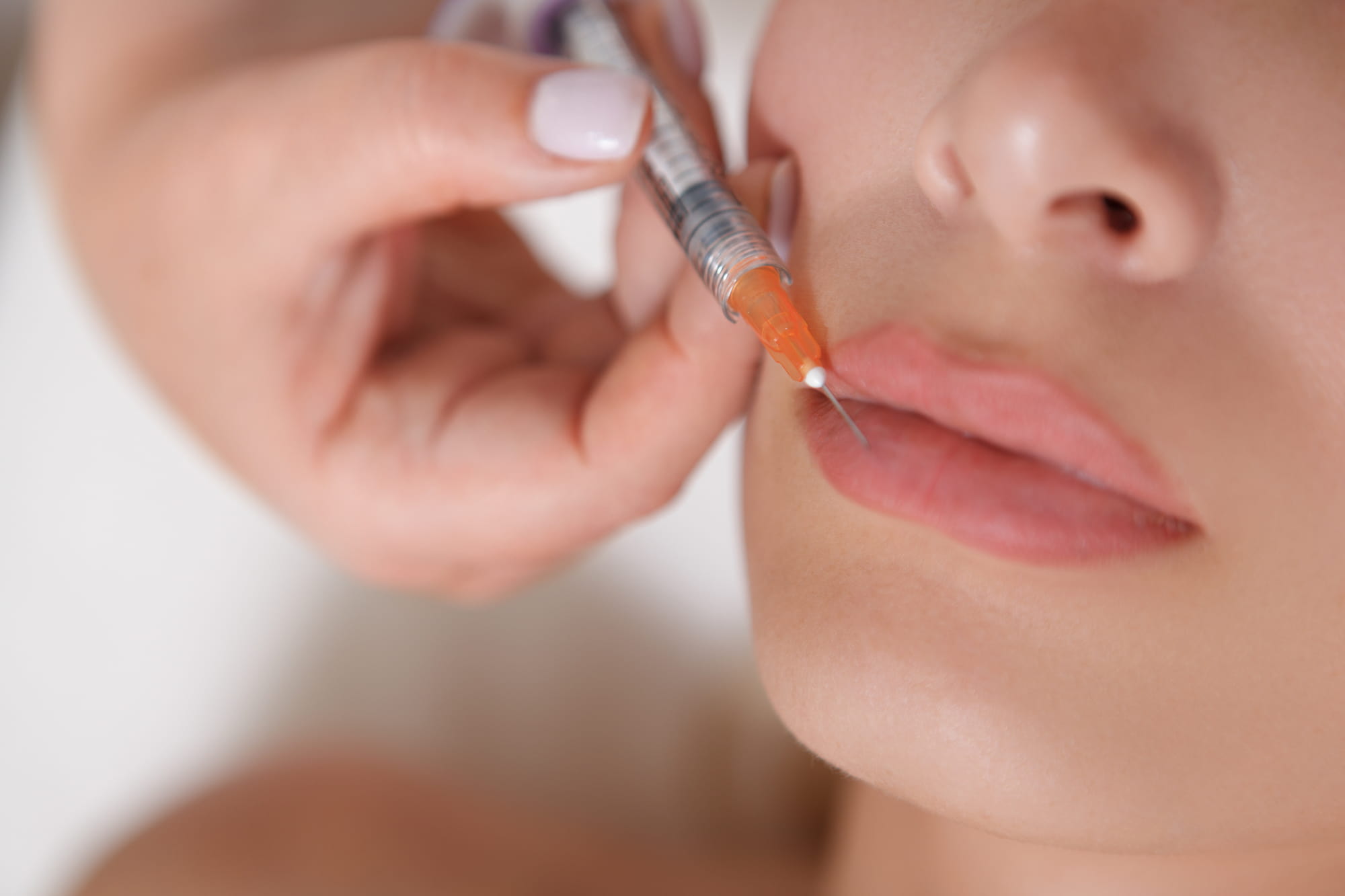 lip filler injected into a woman's lip