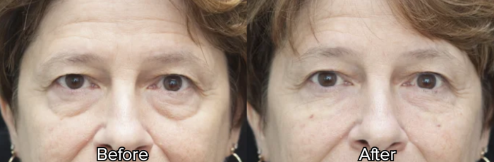 A photo showing before-and-after facial rejuvenation with different styles.