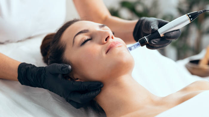 How Teosyal Meso treatments are performed.