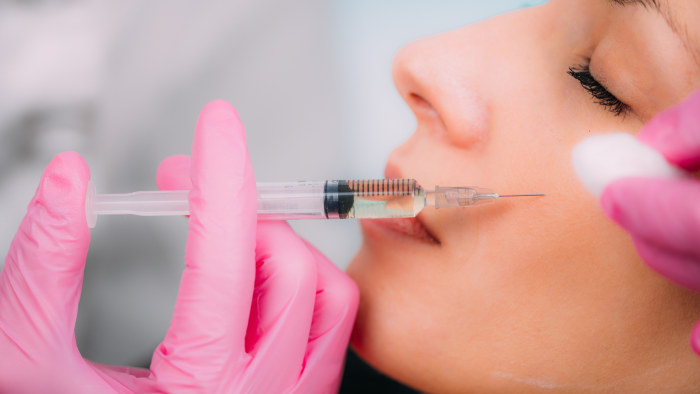 Facial sculpting with Radiesse.