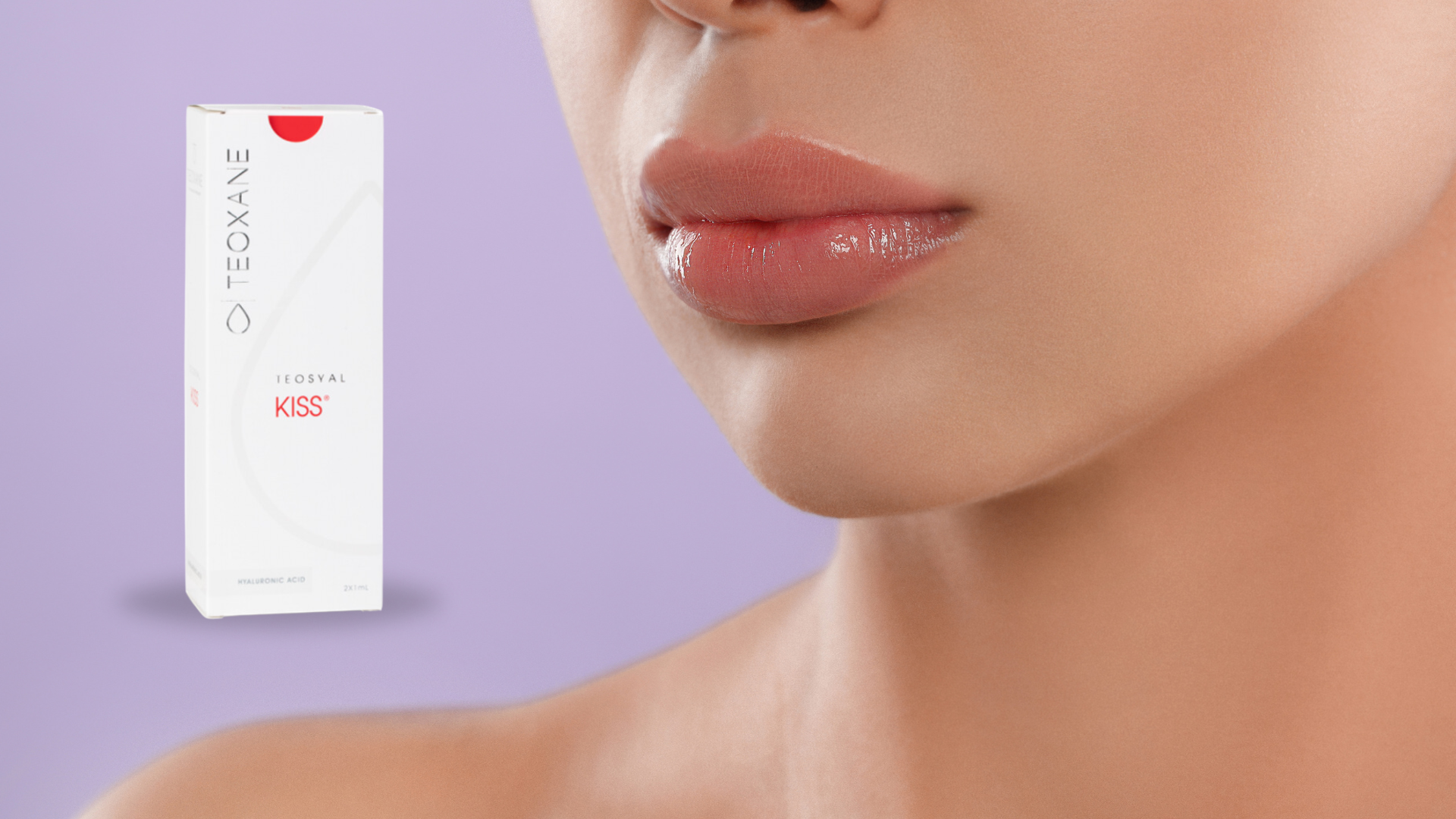 Woman's lips after getting Teosyal Lip Filler.