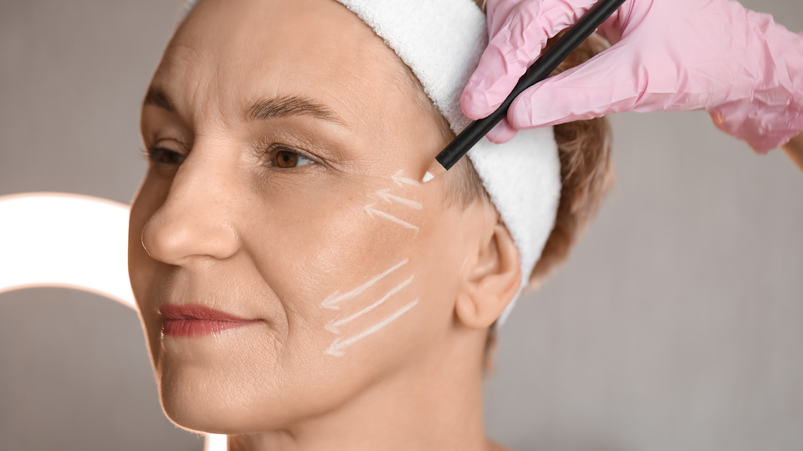 A healthcare professional determines the proper injection points for a patient receiving Restylane.