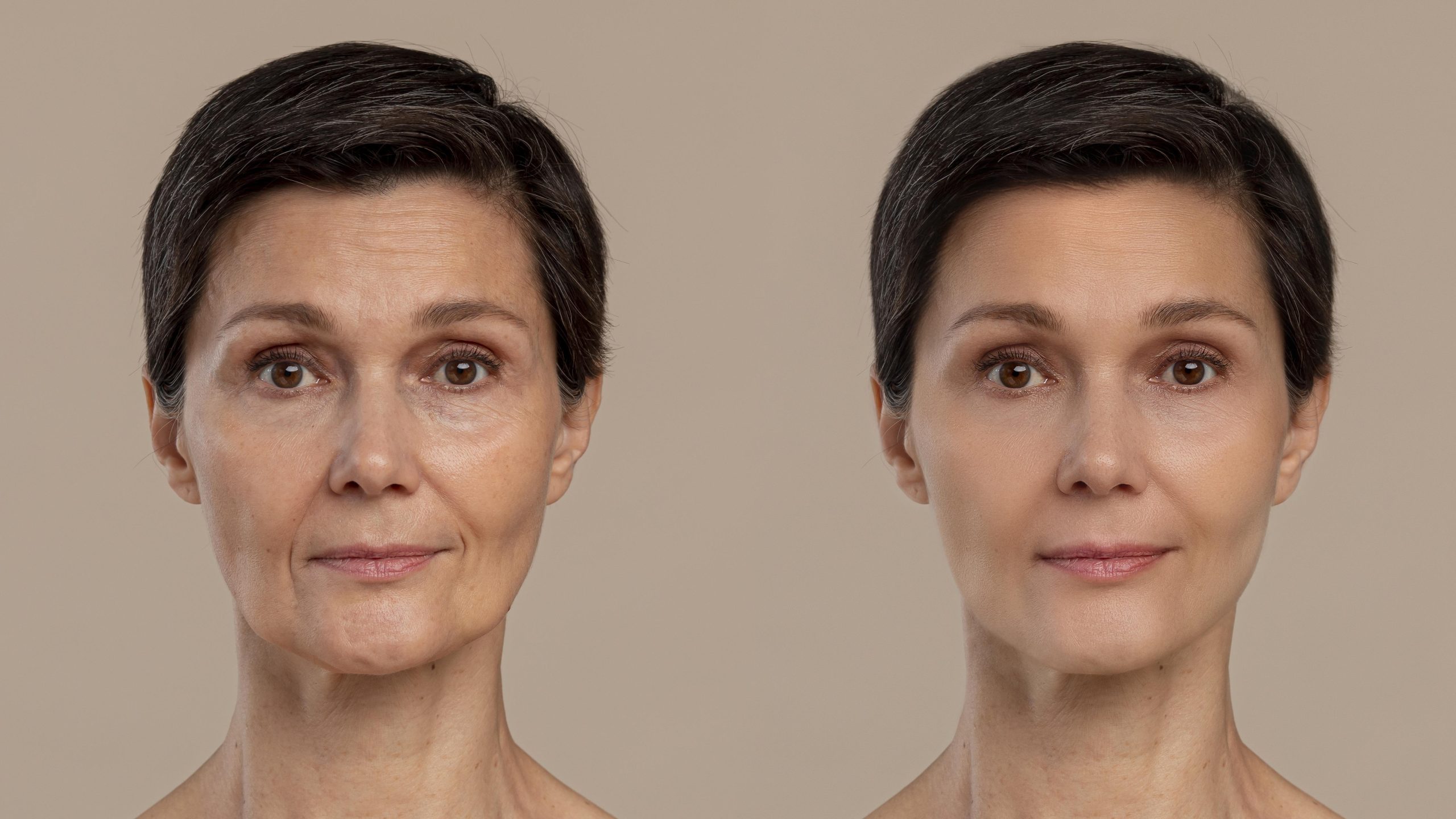 before and after