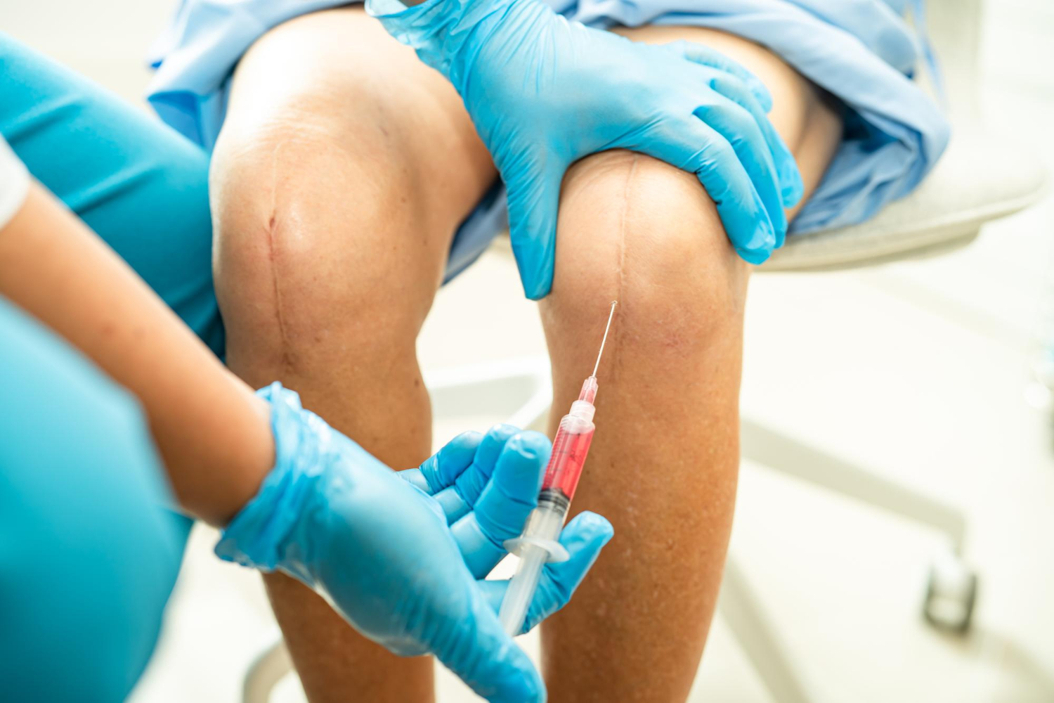Injecting the knee