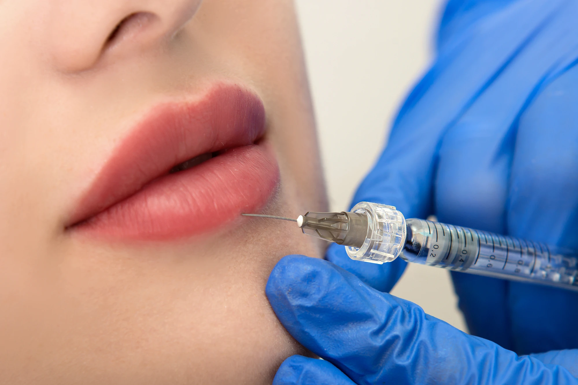 closeup of a woman getting lip filler