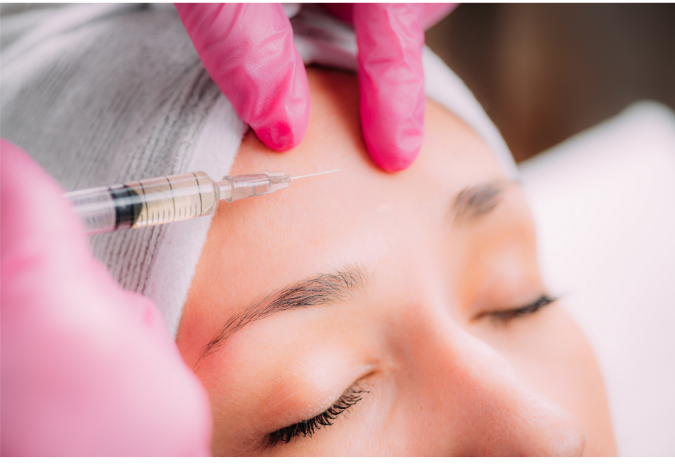 dermal filler in the forehead