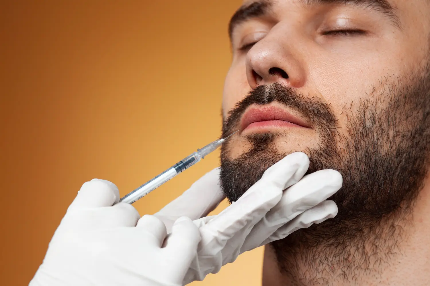 dermal fillers for smile lines