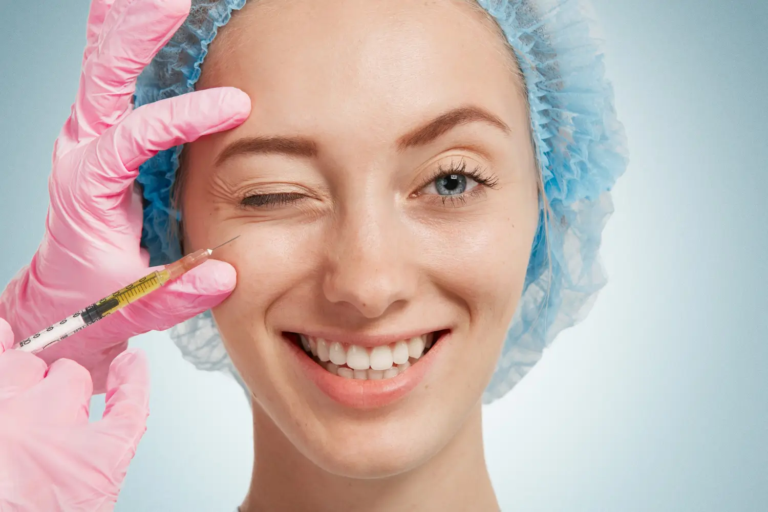 restylane injection points