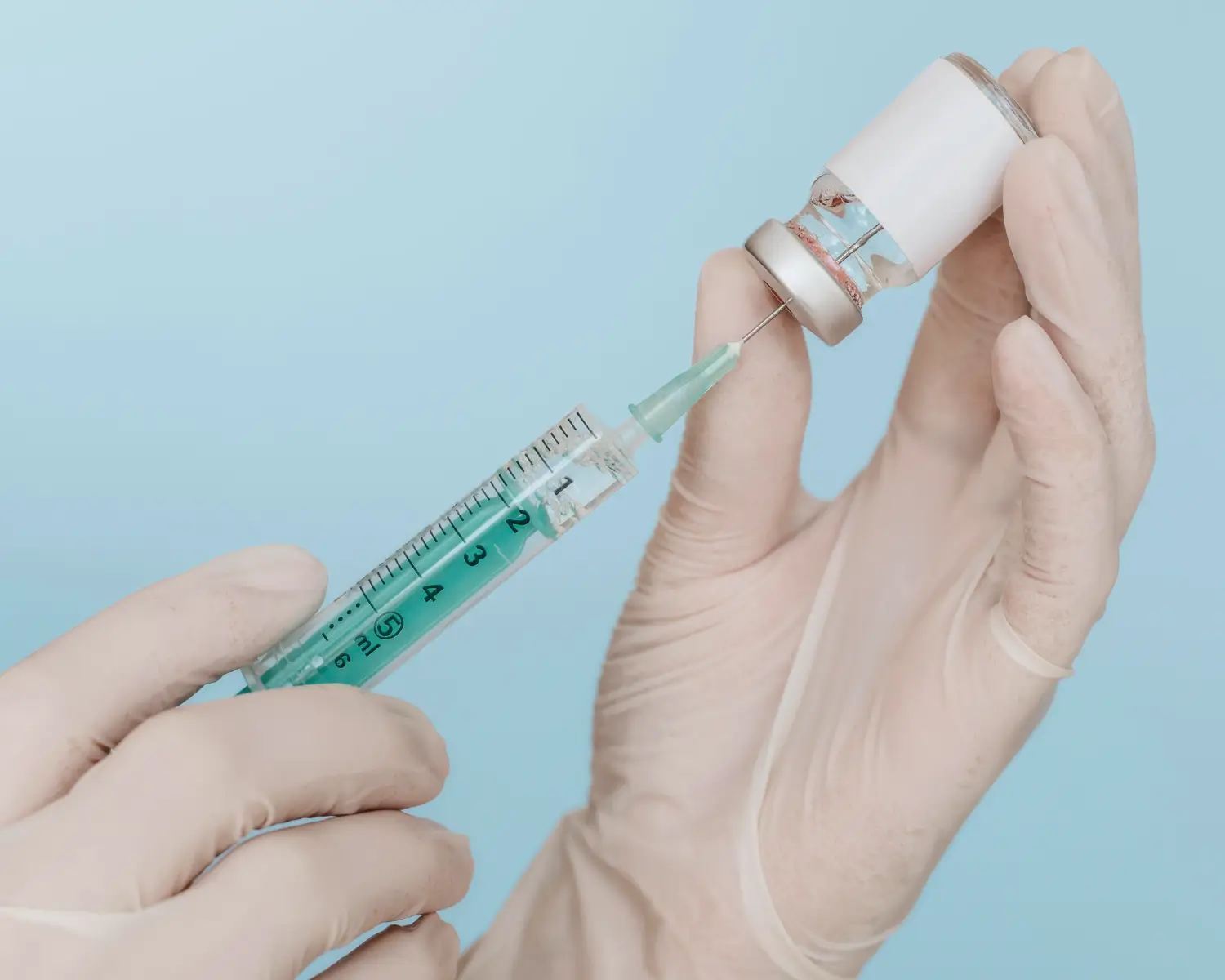 Xeomin injection sites
