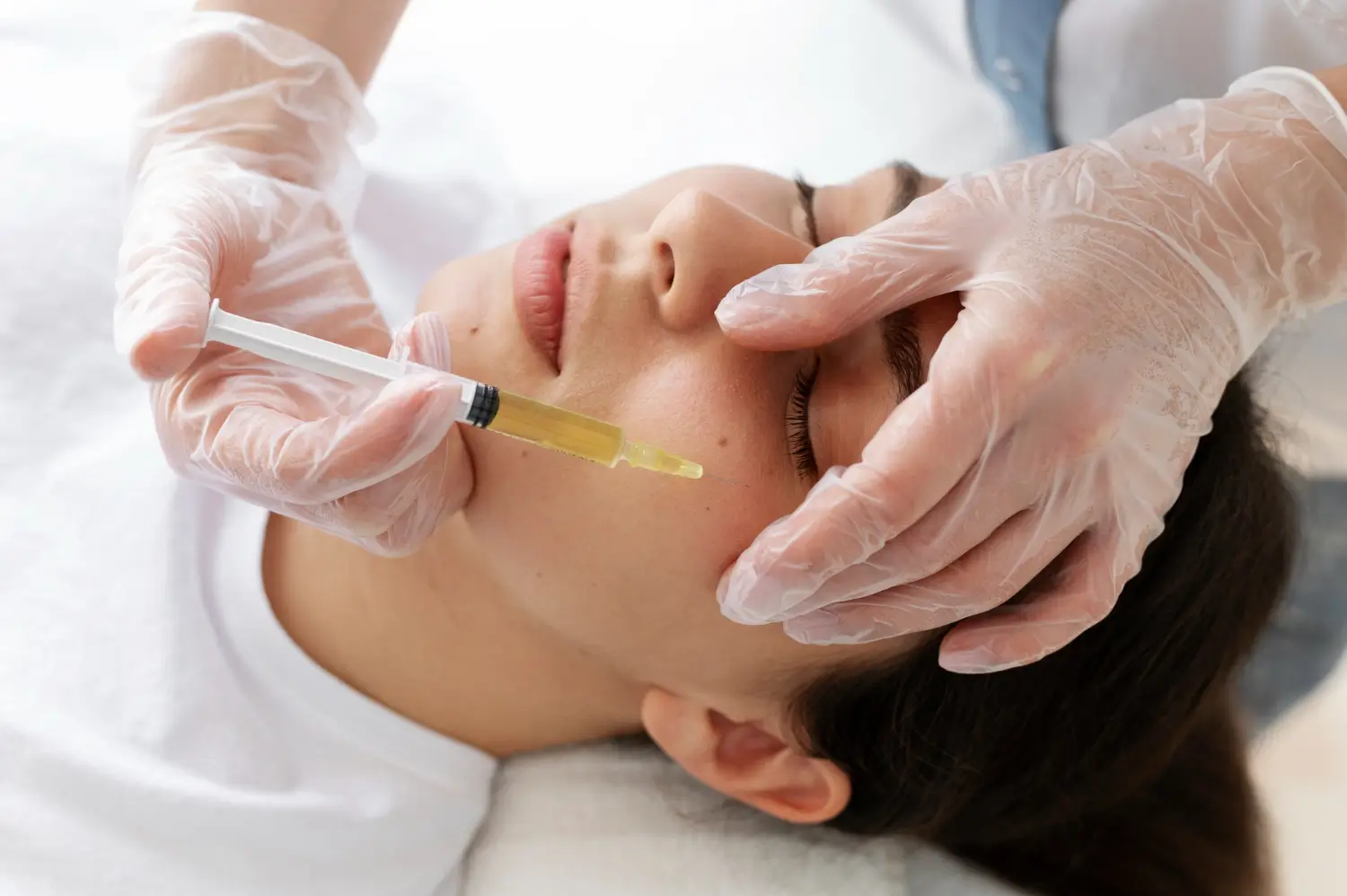 Sculptra for face