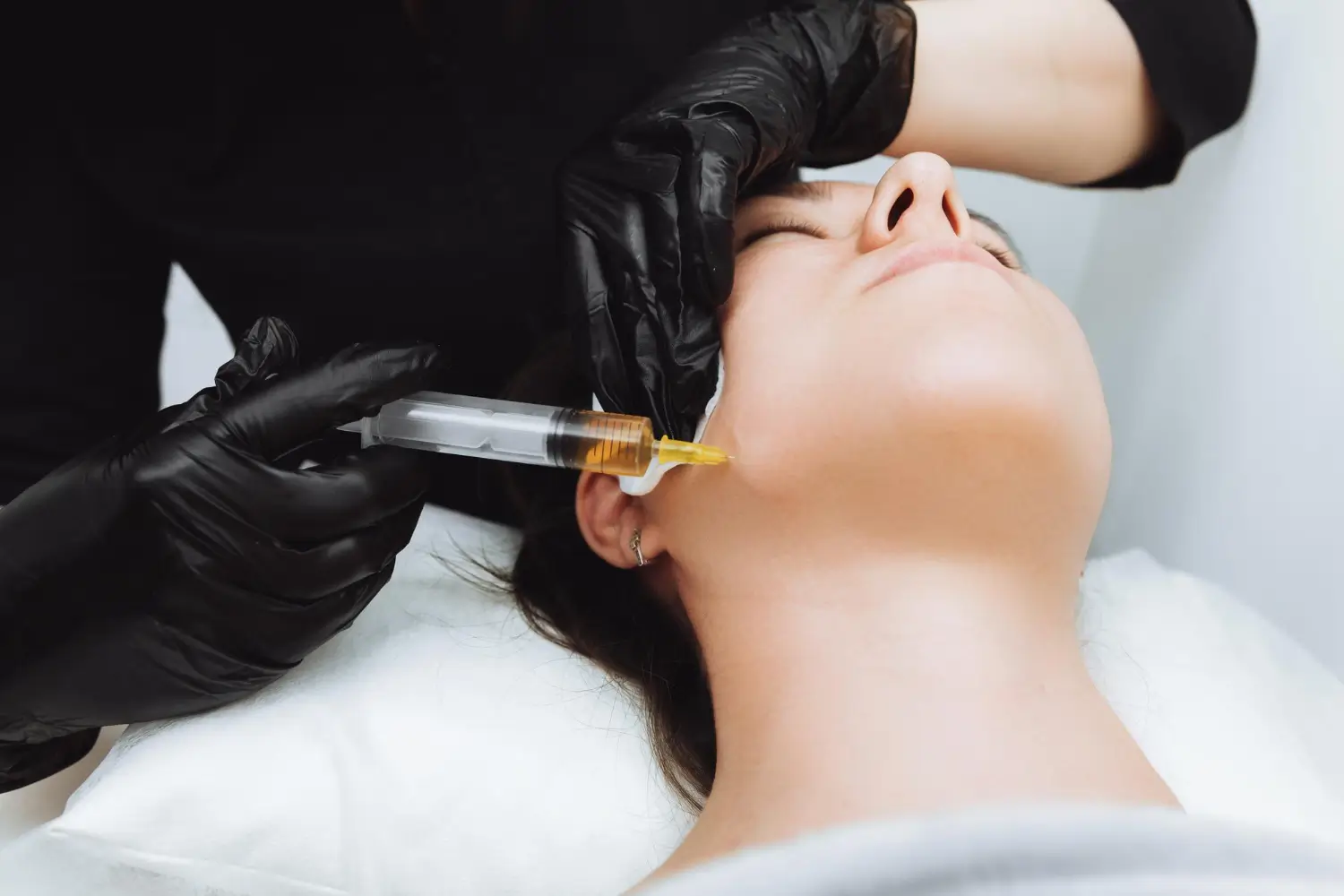 Sculptra vs. Juvederm