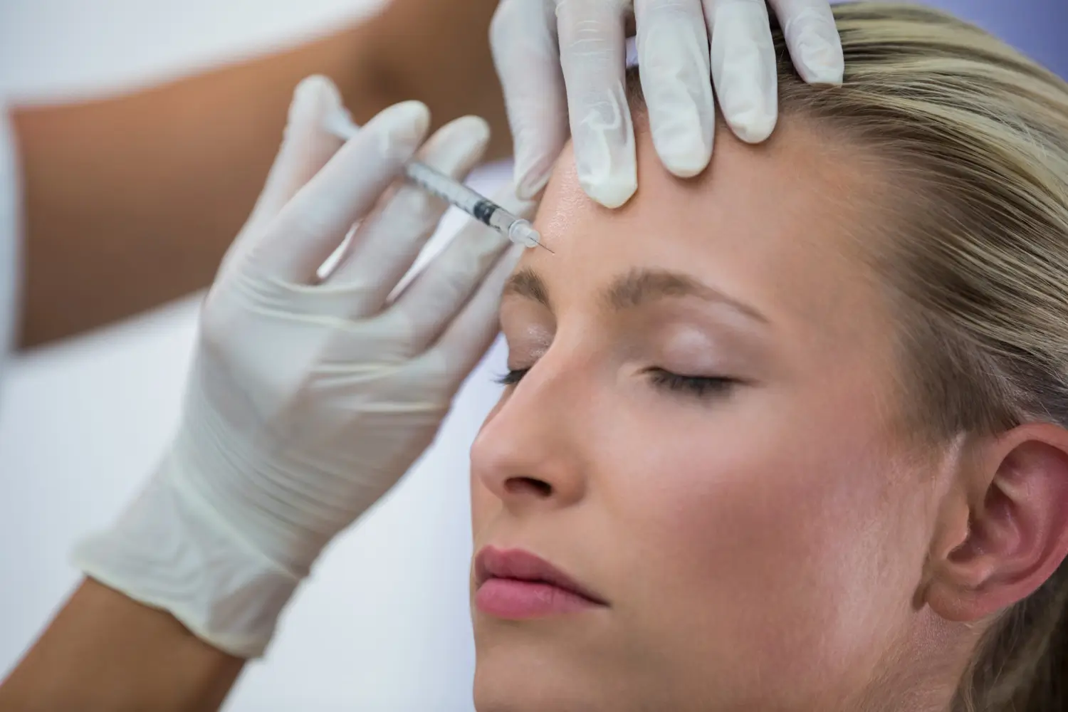 A person with closed eyes receives an Ellanse injection in the forehead from a practitioner wearing white gloves. The background is softly blurred, emphasizing the medical procedure.