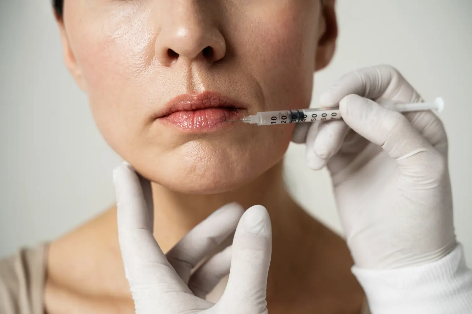 lip filler injection