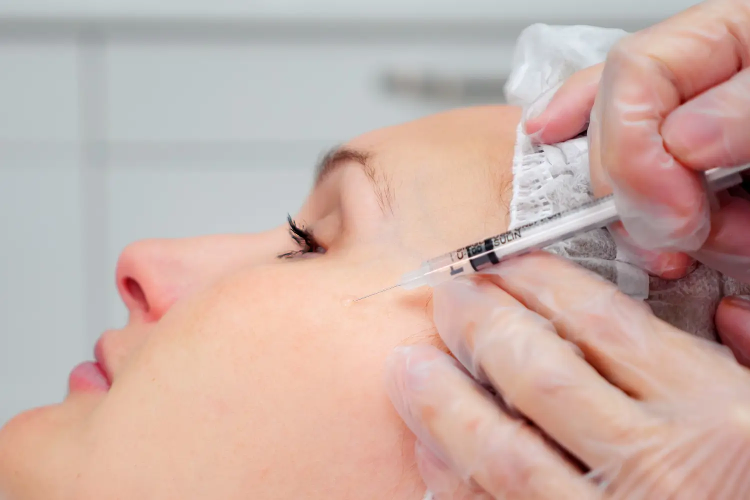Skillful and careful injection for facial rejuvenation