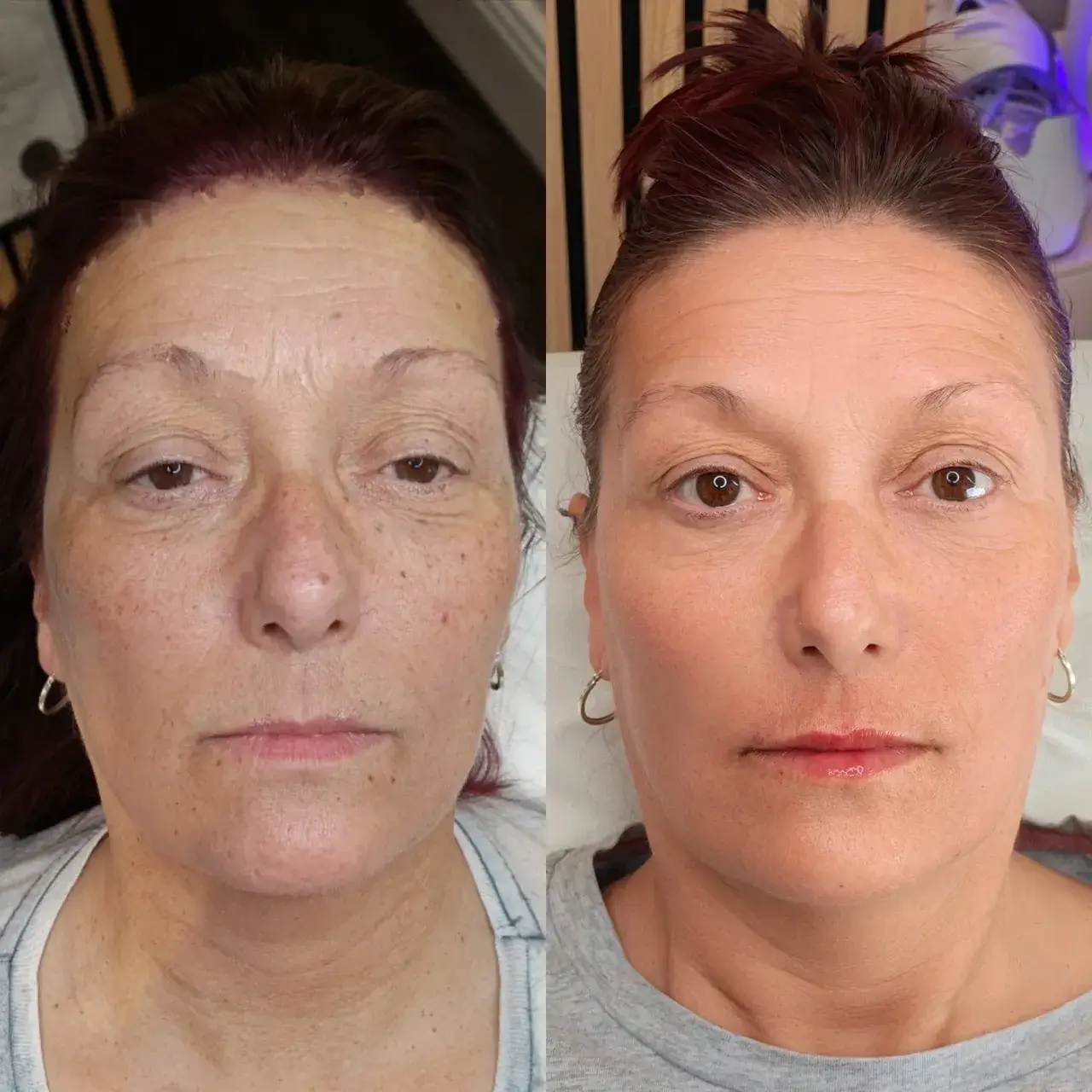 Jalupro before and after