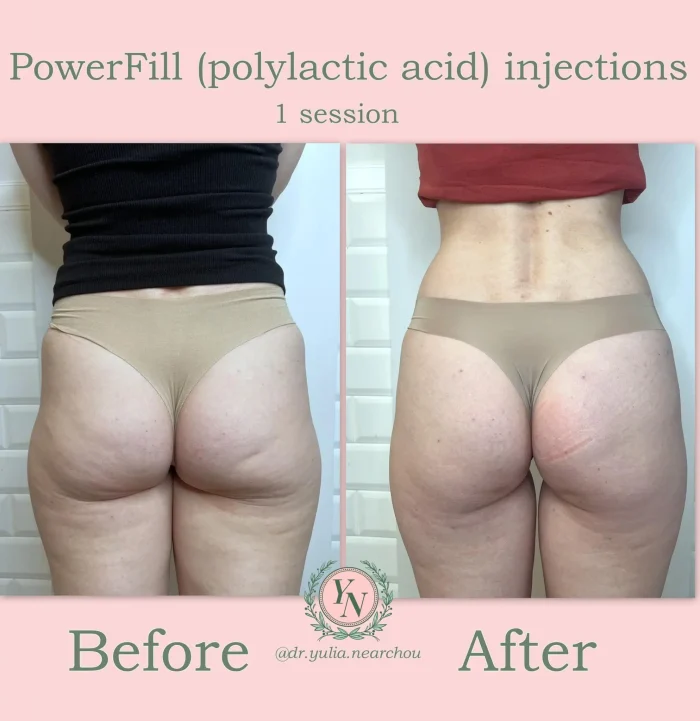 Powerfill before and after comparison