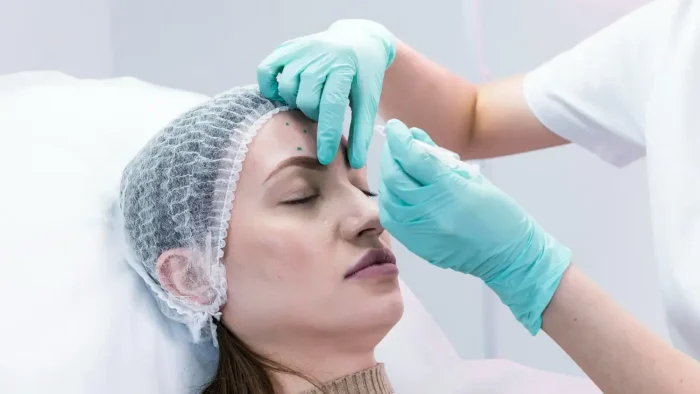 A healthcare professional starts administering Ellanse filler for forehead wrinkles