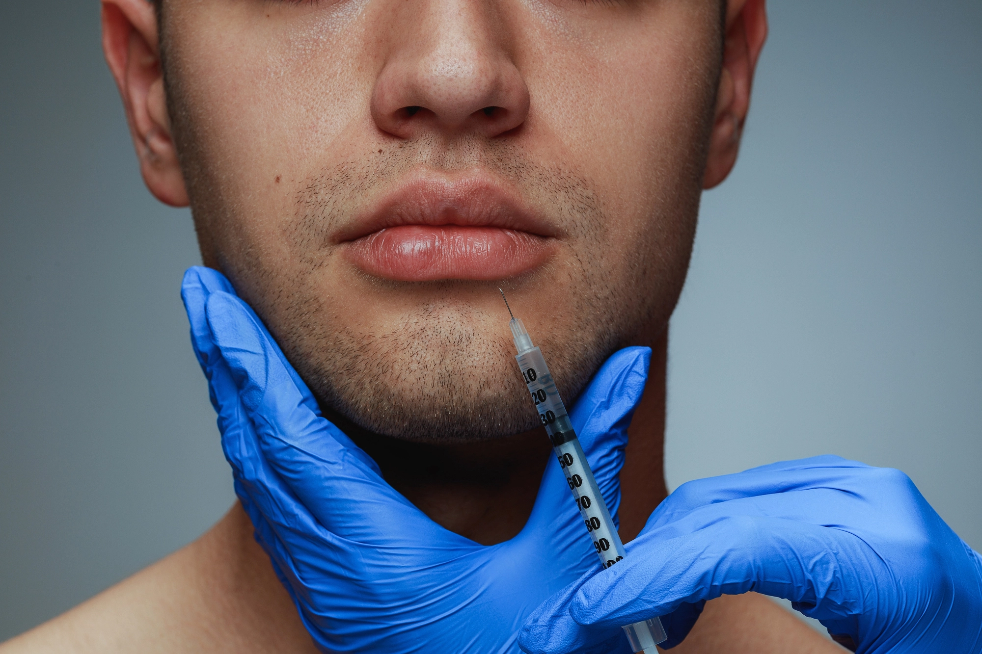 Close-up of a person receiving a cosmetic injection in the chin area, possibly hinting at male lip fillers. A hand in blue medical gloves holds the syringe and gently touches the chin, set against a neutral background.