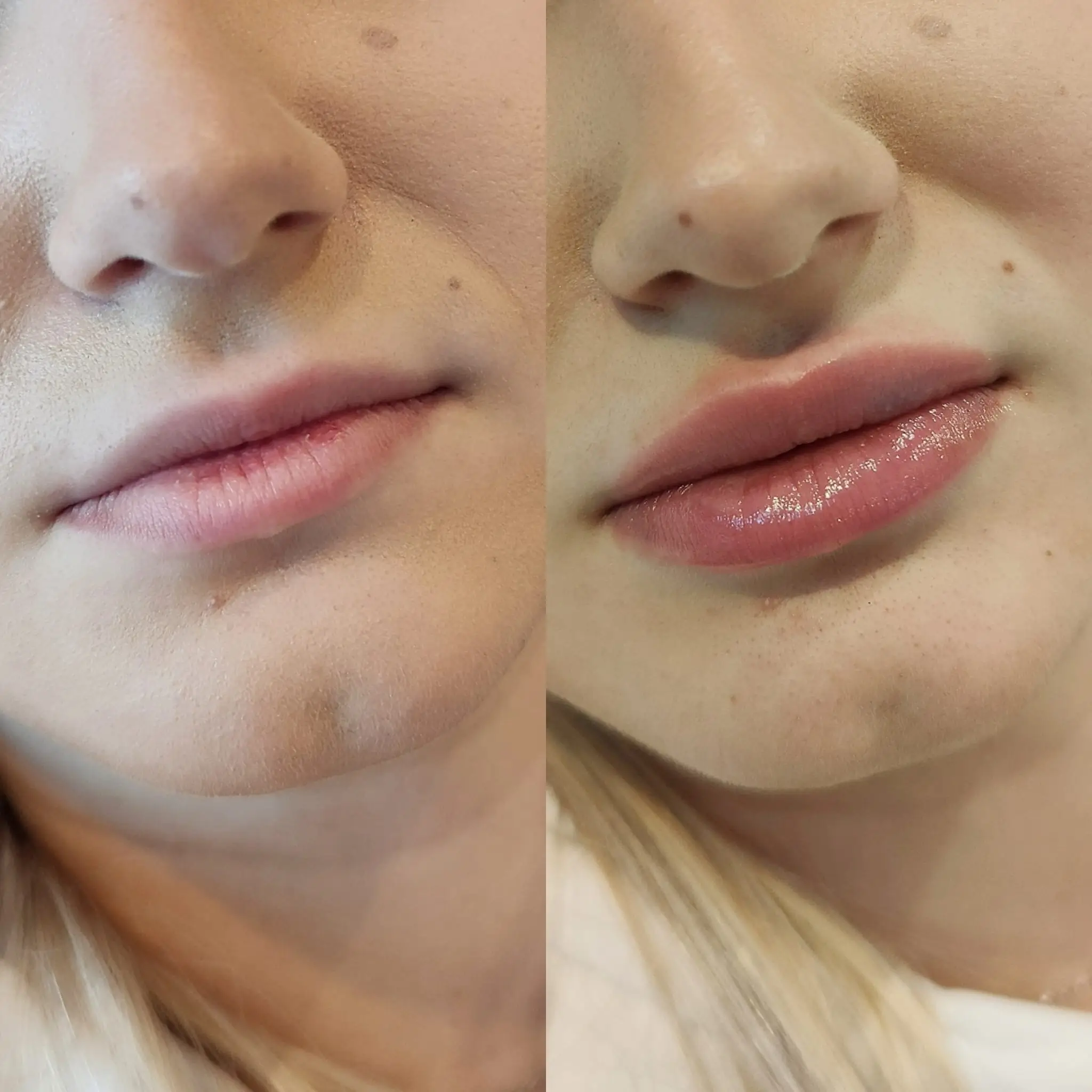 her clef chin