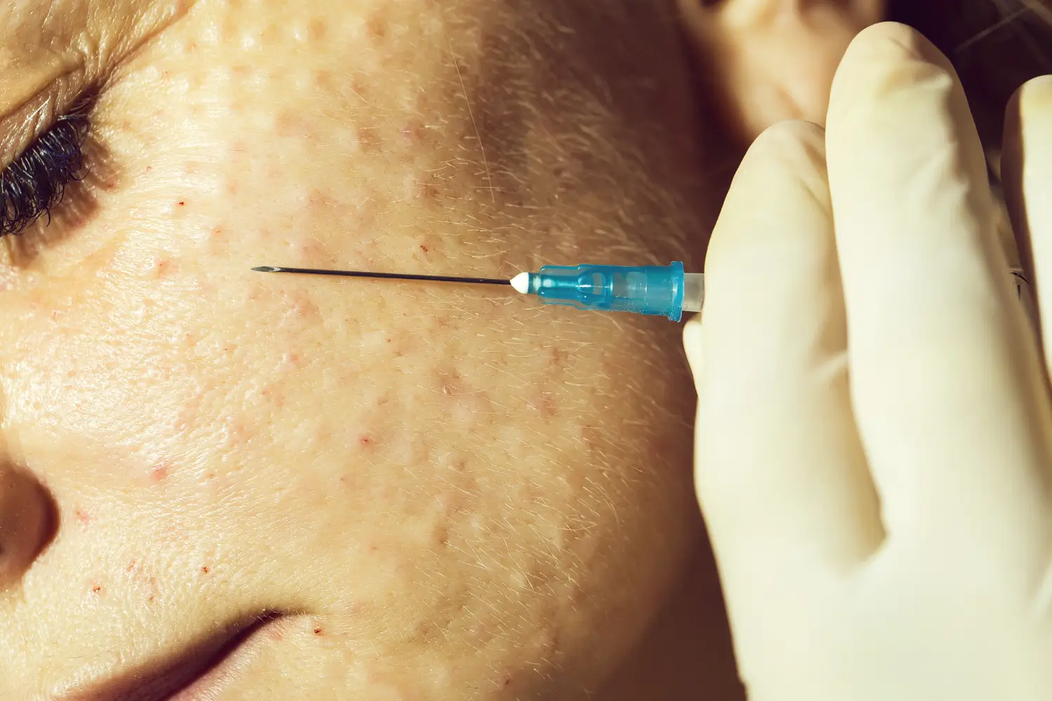 patient's face got lumps and red spots after