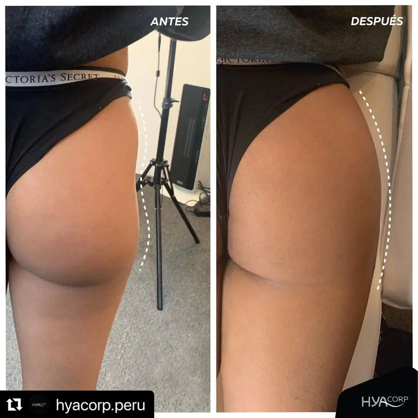 the perfect butt