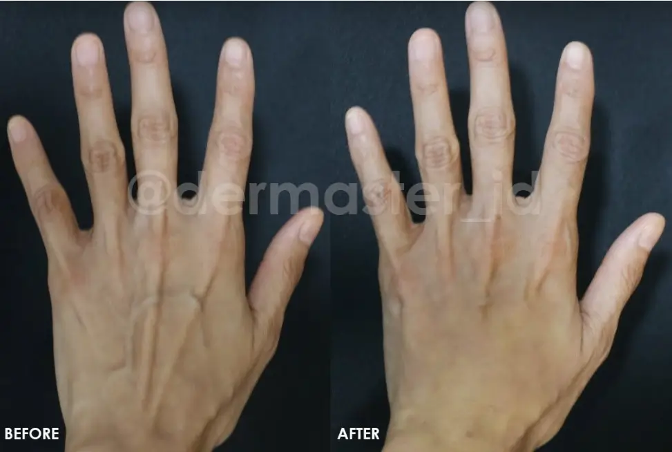 younger skin
