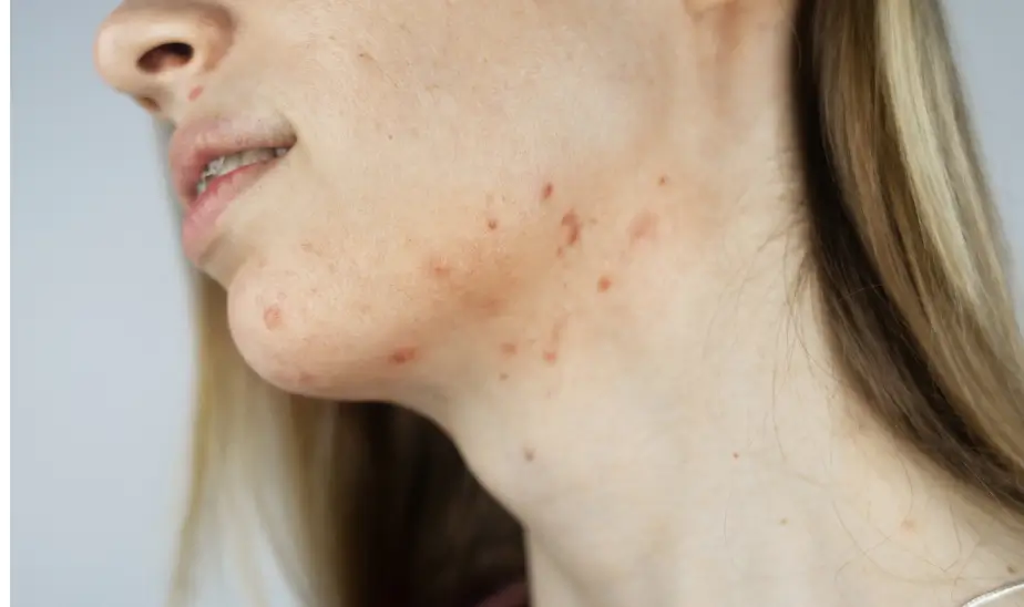 red spots