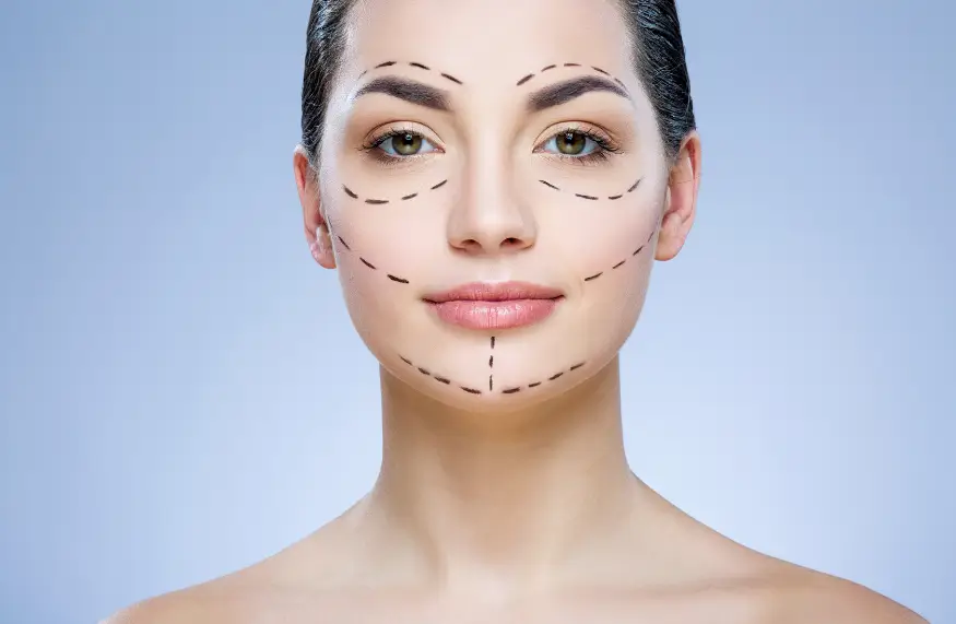 patient's face is marked for faster operation