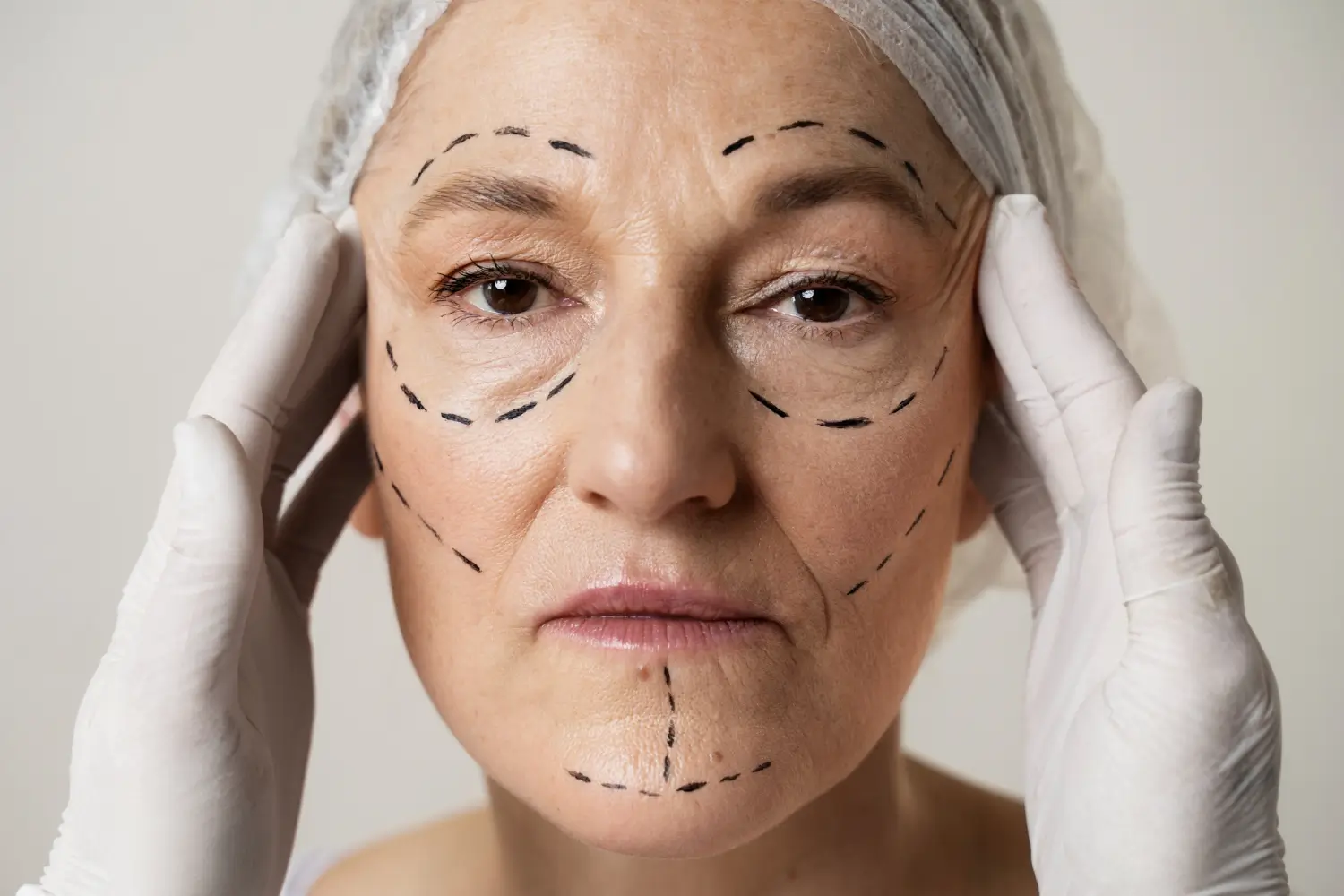 patient having marks in her face for operation