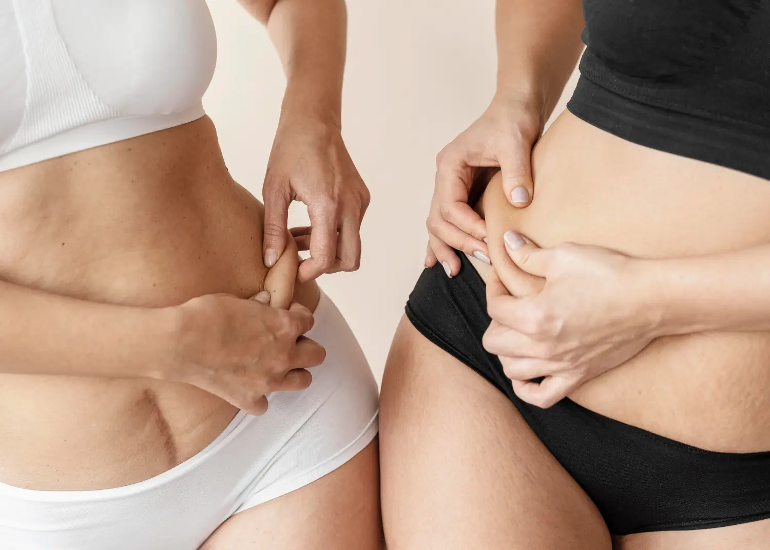 their tummies have a bulk of cellulite