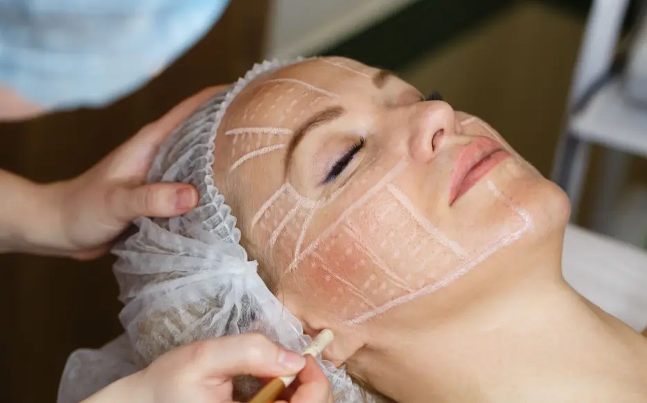 markings in her face