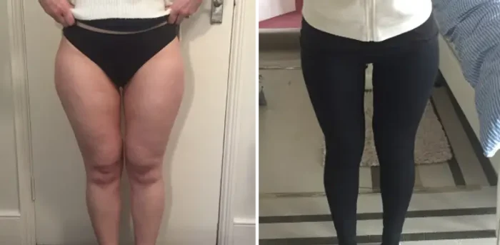 slimmer thighs