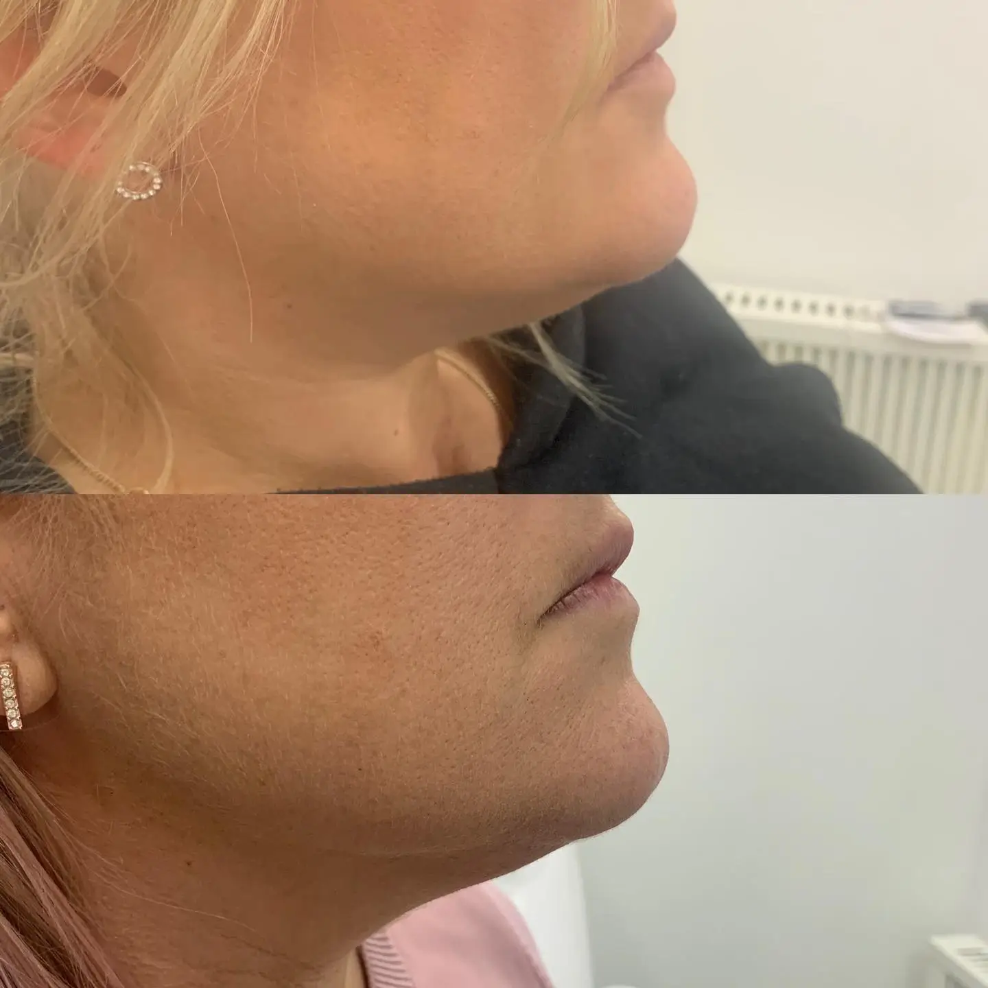 more defined chin