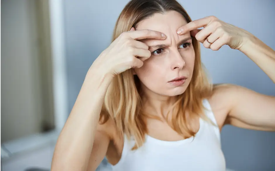 lines in the forehead