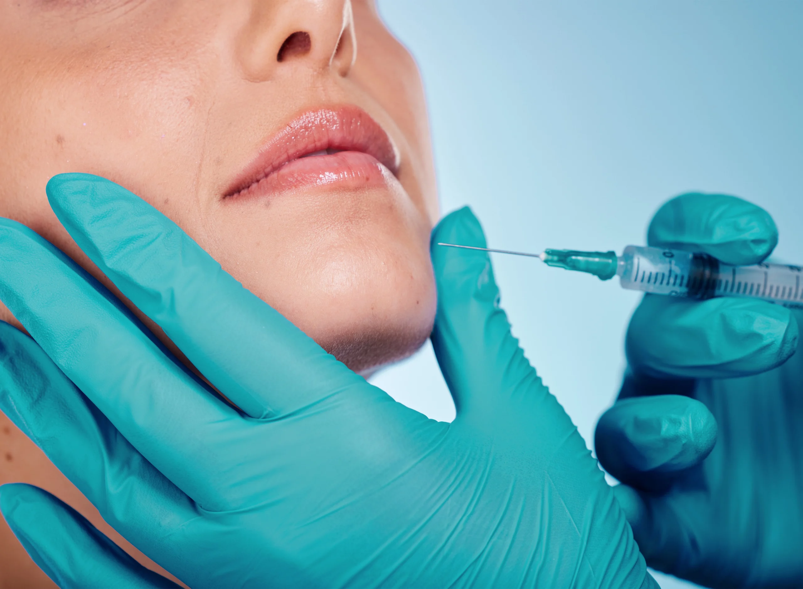 Dermal Filler Removal