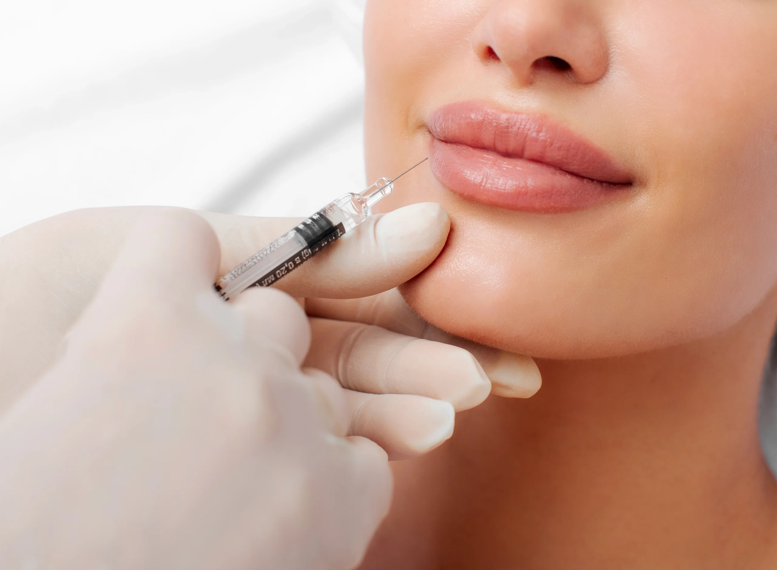 Dermal Fillers