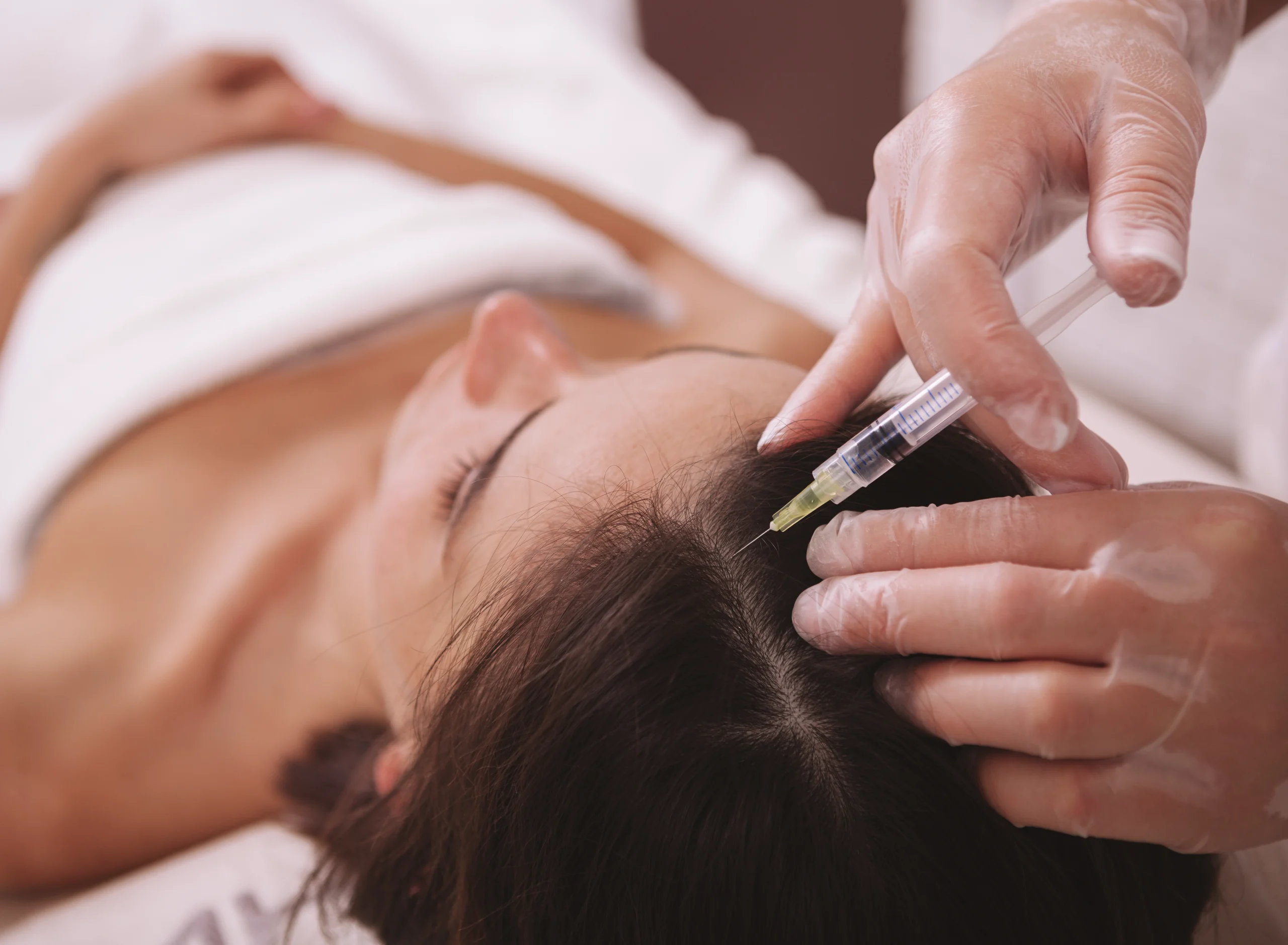 Mesotherapy