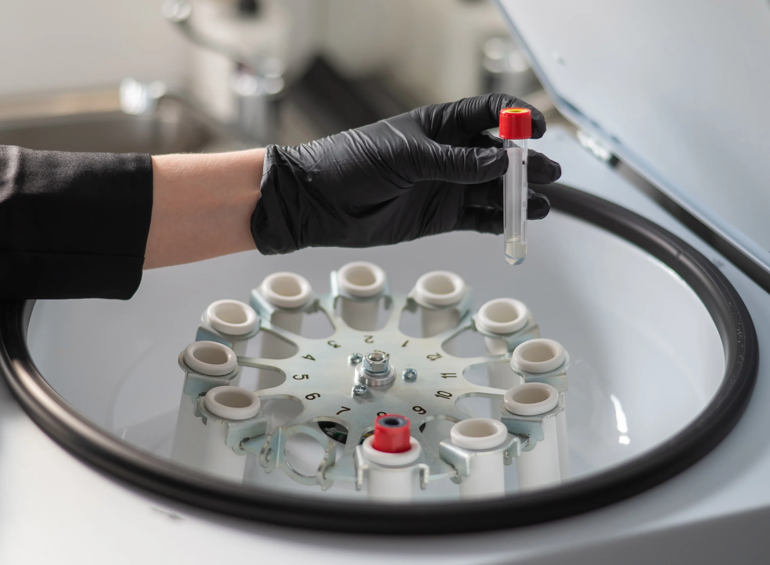 PRP Kits